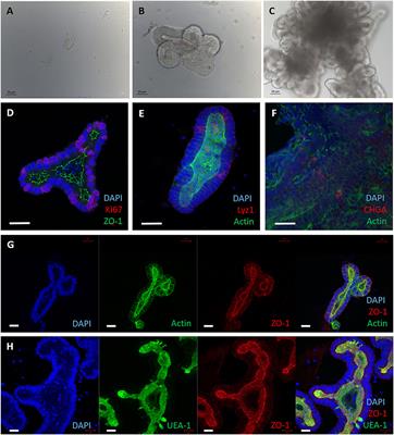 The Development of 3D Bovine Intestinal Organoid Derived Models to Investigate Mycobacterium Avium ssp Paratuberculosis Pathogenesis